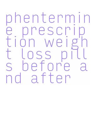 phentermine prescription weight loss pills before and after