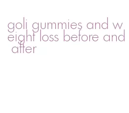 goli gummies and weight loss before and after