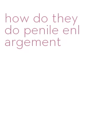 how do they do penile enlargement