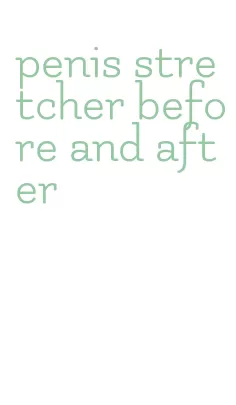 penis stretcher before and after