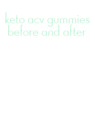 keto acv gummies before and after