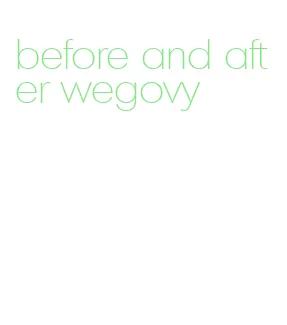 before and after wegovy
