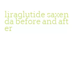 liraglutide saxenda before and after